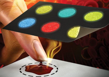 تشخیص سریع سرطان خون با اختراع پژوهشگران شیرازی