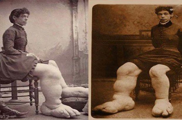 واقعیت‌های عجیب و غریب در طول تاریخ+تصاویر